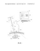 ECOGENIC COOLED MICROWAVE ABLATION ANTENNA diagram and image