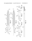 ORTHOPEDIC IMPLANT KIT diagram and image