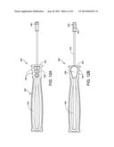 ORTHOPEDIC IMPLANT KIT diagram and image