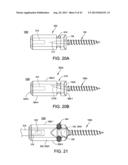 ORTHOPEDIC IMPLANT KIT diagram and image