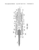 ORTHOPEDIC IMPLANT KIT diagram and image