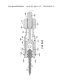 ORTHOPEDIC IMPLANT KIT diagram and image