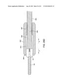 ORTHOPEDIC IMPLANT KIT diagram and image