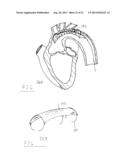 EMBOLIC PROTECTION DEVICES, VASCULAR DELIVERY CATHETERS, AND METHODS OF     DEPLOYING SAME diagram and image