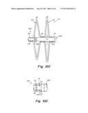 Catch Member for PFO Occluder diagram and image