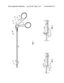 Suturing Apparatus and Method diagram and image