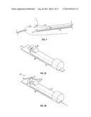 Suturing Apparatus and Method diagram and image