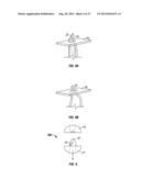 Suturing Apparatus and Method diagram and image