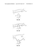 Suturing Apparatus and Method diagram and image