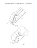 Suturing Apparatus and Method diagram and image