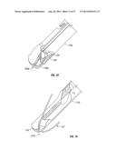 Suturing Apparatus and Method diagram and image