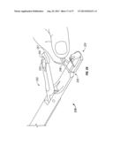 Suturing Apparatus and Method diagram and image