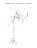 Suturing Apparatus and Method diagram and image