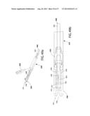 Suturing Apparatus and Method diagram and image