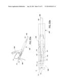 Suturing Apparatus and Method diagram and image