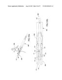 Suturing Apparatus and Method diagram and image