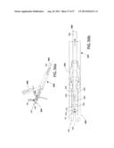 Suturing Apparatus and Method diagram and image