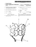 METHOD AND APPARATUS TO PROMOTE INFLAMMATION IN SPINAL TISSUES diagram and image