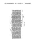 LONGITUDINALLY FLEXIBLE EXPANDABLE STENT diagram and image