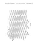 LONGITUDINALLY FLEXIBLE EXPANDABLE STENT diagram and image