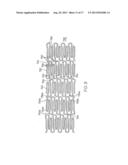 LONGITUDINALLY FLEXIBLE EXPANDABLE STENT diagram and image