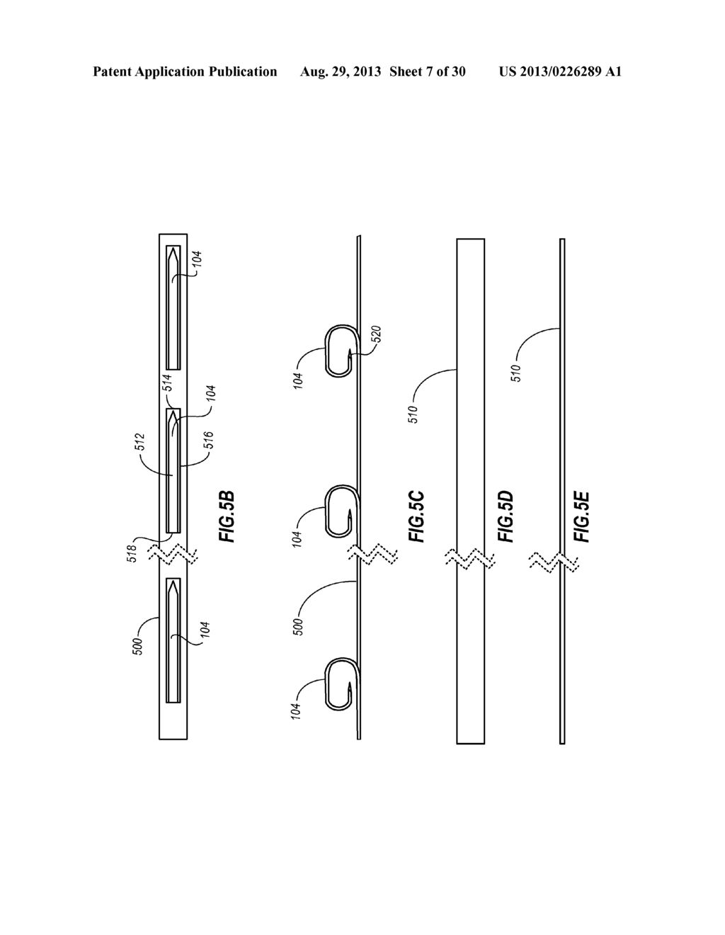 PERCUTANEOUS ANNULOPLASTY SYSTEM WITH ANTERIOR-POSTERIOR ADJUSTMENT - diagram, schematic, and image 08