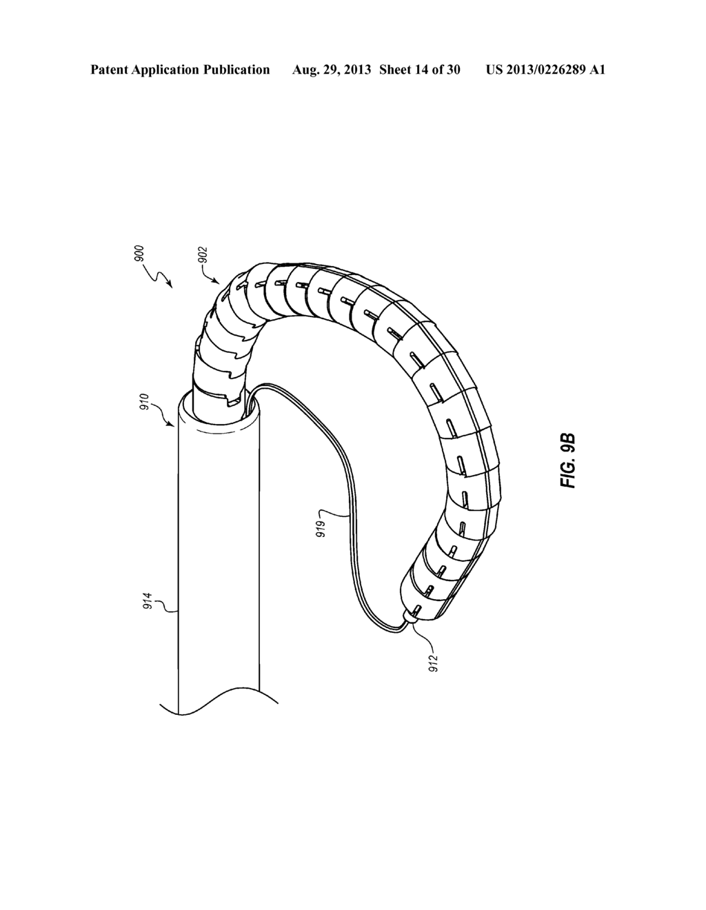 PERCUTANEOUS ANNULOPLASTY SYSTEM WITH ANTERIOR-POSTERIOR ADJUSTMENT - diagram, schematic, and image 15