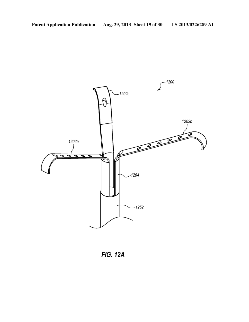 PERCUTANEOUS ANNULOPLASTY SYSTEM WITH ANTERIOR-POSTERIOR ADJUSTMENT - diagram, schematic, and image 20