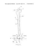 FEMORAL PROSTHESIS WITH MEDIALIZED PATELLAR GROOVE diagram and image