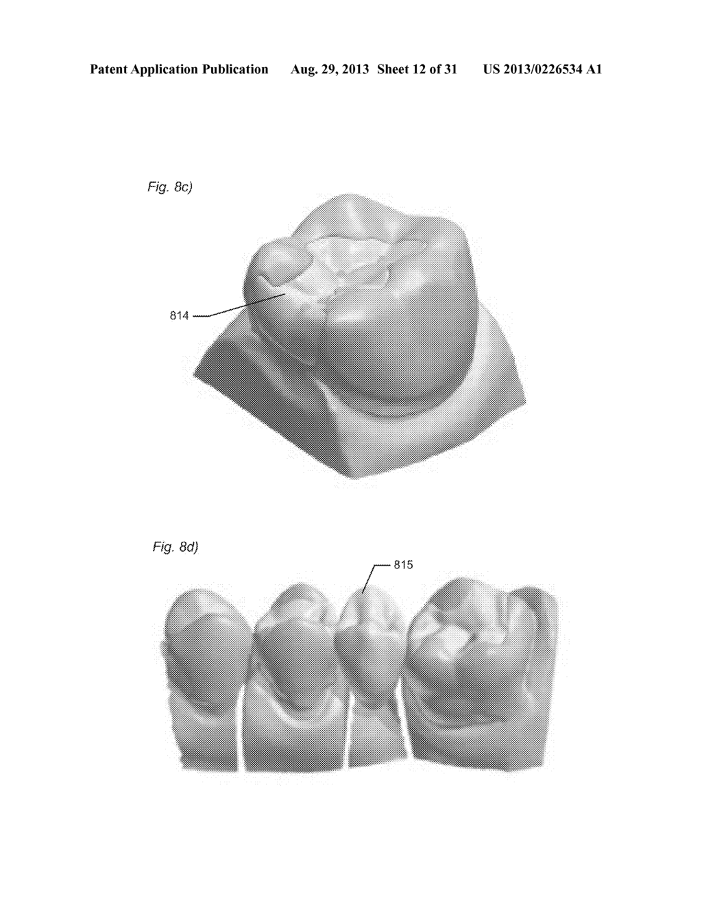 DESIGNING A VIRTUAL PREPARATION AND A VIRTUAL GINGIVAL - diagram, schematic, and image 13