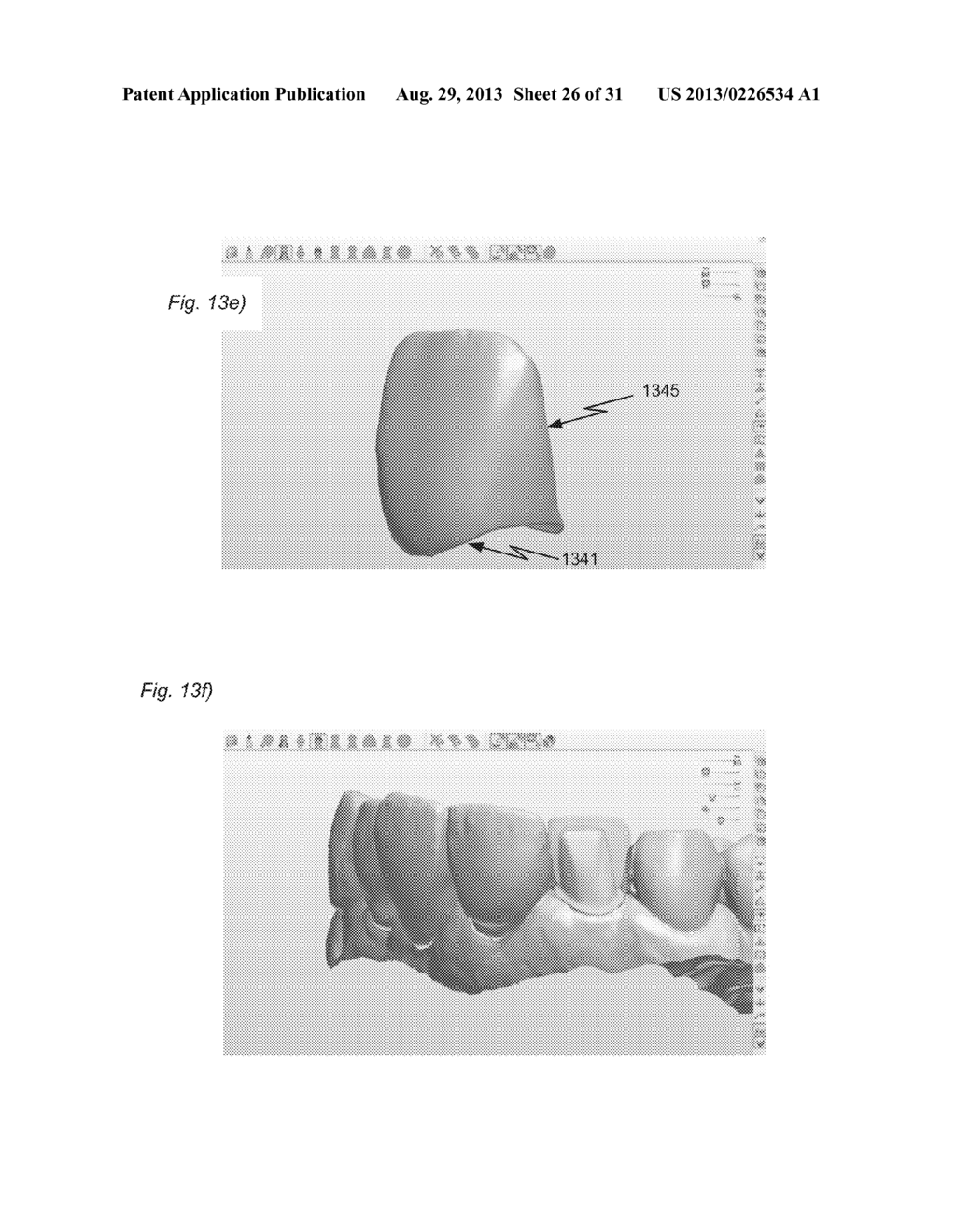 DESIGNING A VIRTUAL PREPARATION AND A VIRTUAL GINGIVAL - diagram, schematic, and image 27