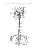 APPARATUS FOR, AND METHOD OF, LANDING ITEMS AT A WELL LOCATION diagram and image