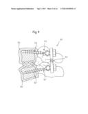 ELASTIC ELEMENT FOR THE USE IN A STABILIZATION DEVICE FOR BONES AND     VERTEBRAE AND METHOD FOR THE MANUFACTURE OF SUCH ELASTIC ELEMENT diagram and image