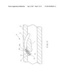 Apparatus and Method for Resectioning Gastro-Esophageal Tissue diagram and image