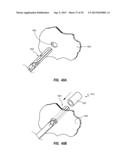 AIRBAG ASSEMBLIES WITH STABILIZER STRAPS diagram and image