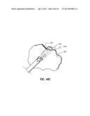 AIRBAG ASSEMBLIES WITH STABILIZER STRAPS diagram and image