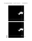 Local Screen and Method for the Screening Out of Magnetic Resonance     Signals diagram and image