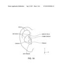 EARPIECE PASSIVE NOISE ATTENUATING diagram and image