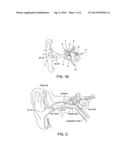 EARPIECE PASSIVE NOISE ATTENUATING diagram and image