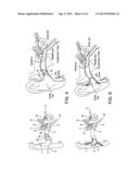 EARPIECE PASSIVE NOISE ATTENUATING diagram and image