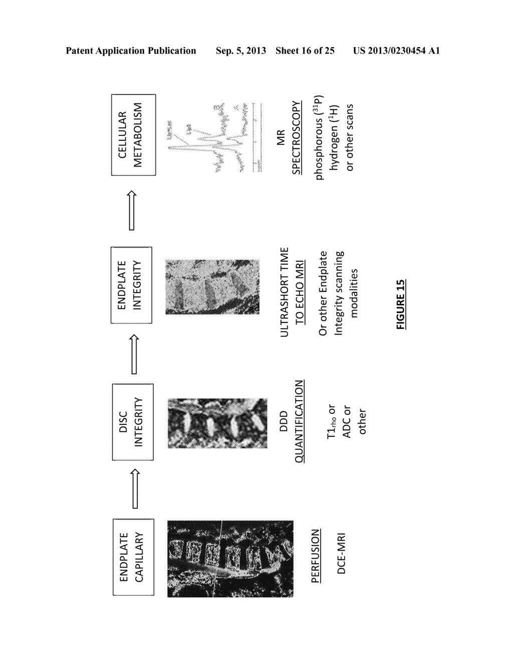 Therapeutic Angiogenesis for Treatment of the Spine and Other Tissues - diagram, schematic, and image 17