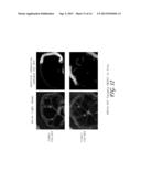 PAPILLOMAVIRUS PSEUDOVIRUSES FOR DETECTION AND THERAPY OF TUMORS diagram and image