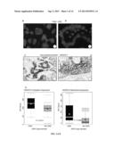 BIOMARKERS FOR RESPONSE TO TYROSINE KINASE PATHWAY INHIBITORS IN CANCER diagram and image