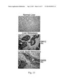 INHIBITORS OF THE ATB(0,+) TRANSPORTER AND USES THEREOF diagram and image