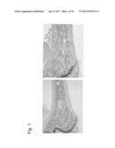 PHARMACEUTICAL COMPOSITION FOR TREATING BONE DISEASES WHICH COMPRISES     PROTEIN COMPRISING FRIZZLED1, FRIZZLED2 OR FRIZZLED7 EXTRACELLULAR     CYSTEINE-RICH DOMAIN diagram and image