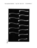 PHARMACEUTICAL COMPOSITION FOR TREATING BONE DISEASES WHICH COMPRISES     PROTEIN COMPRISING FRIZZLED1, FRIZZLED2 OR FRIZZLED7 EXTRACELLULAR     CYSTEINE-RICH DOMAIN diagram and image