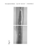 PHARMACEUTICAL COMPOSITION FOR TREATING BONE DISEASES WHICH COMPRISES     PROTEIN COMPRISING FRIZZLED1, FRIZZLED2 OR FRIZZLED7 EXTRACELLULAR     CYSTEINE-RICH DOMAIN diagram and image