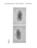 PHARMACEUTICAL COMPOSITION FOR TREATING BONE DISEASES WHICH COMPRISES     PROTEIN COMPRISING FRIZZLED1, FRIZZLED2 OR FRIZZLED7 EXTRACELLULAR     CYSTEINE-RICH DOMAIN diagram and image