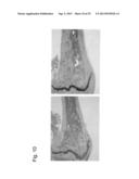 PHARMACEUTICAL COMPOSITION FOR TREATING BONE DISEASES WHICH COMPRISES     PROTEIN COMPRISING FRIZZLED1, FRIZZLED2 OR FRIZZLED7 EXTRACELLULAR     CYSTEINE-RICH DOMAIN diagram and image