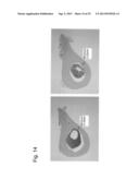 PHARMACEUTICAL COMPOSITION FOR TREATING BONE DISEASES WHICH COMPRISES     PROTEIN COMPRISING FRIZZLED1, FRIZZLED2 OR FRIZZLED7 EXTRACELLULAR     CYSTEINE-RICH DOMAIN diagram and image